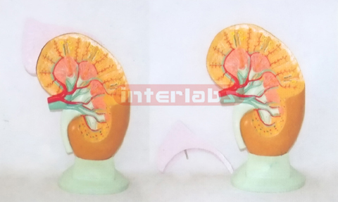 BIG ANATOMICAL ENLARGED KIDNEY MODEL WITH DISSECTABLE ADRENAL GLAND & BASE